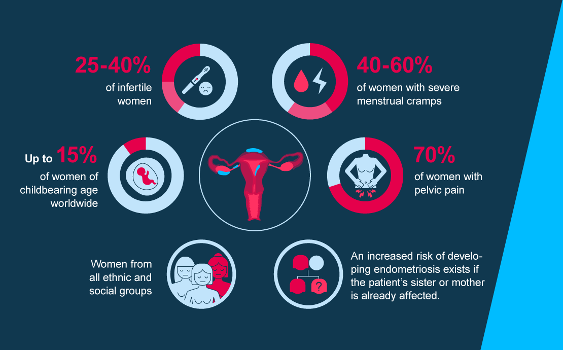 Who is affected by endometriosis