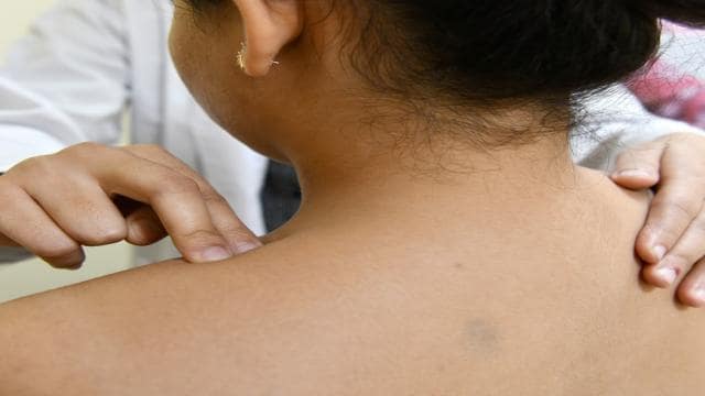 A person receives a medical examination on their back, with a healthcare professional inspecting their shoulder area.